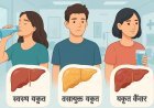 लिवर कैंसर का खतरा: शराब न पीने वाले युवाओं में भी बढ़ रही है यह बीमारी!