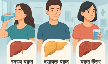 लिवर कैंसर का खतरा: शराब न पीने वाले युवाओं में भी बढ़ रही है यह बीमारी!